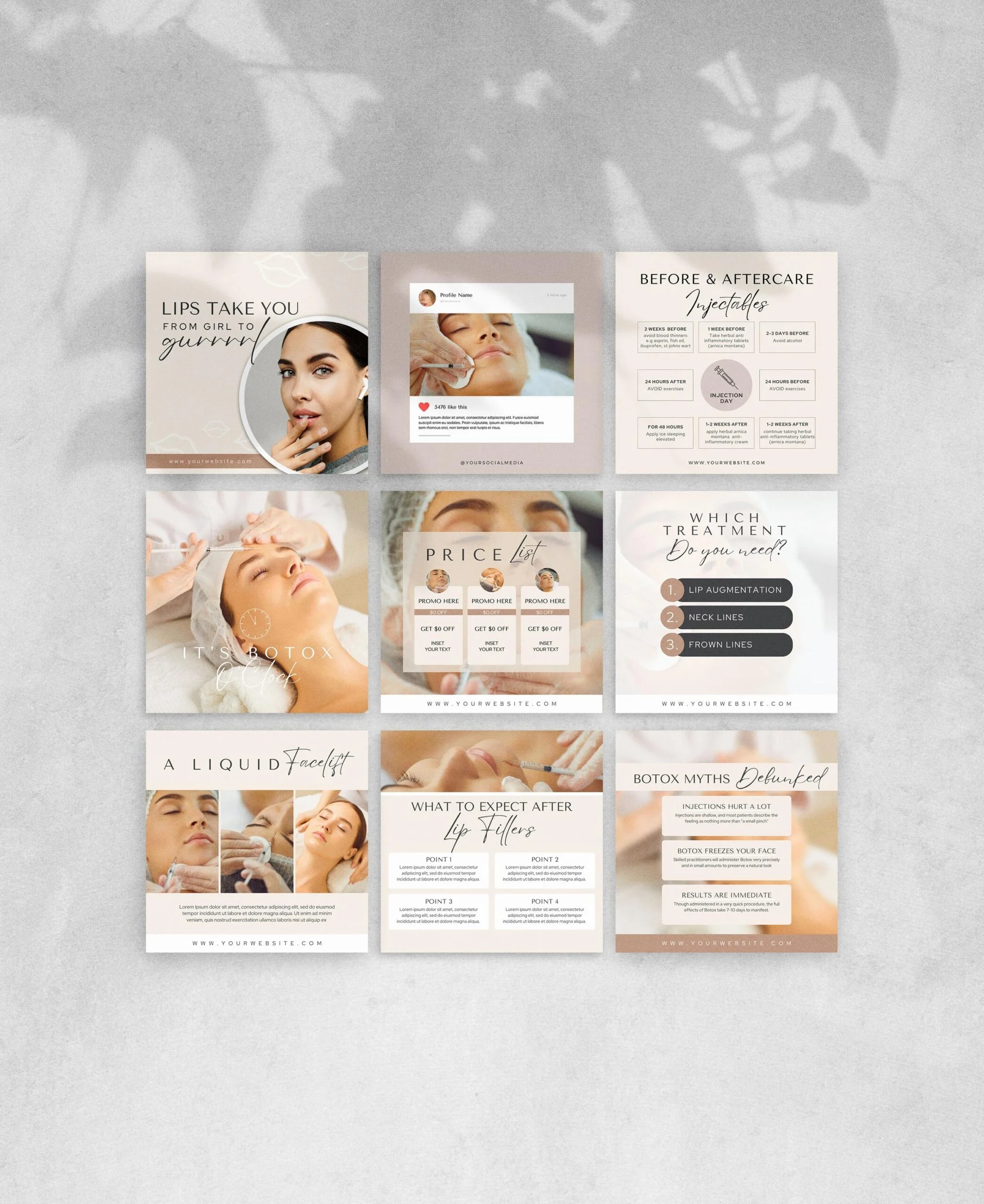 50 Botox & Filler Instagram Posts – Canva Social Media Pack - Image 2